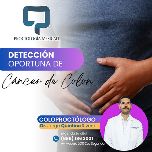 Cómo prevenir el cáncer de colon?